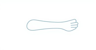 Meaning of Distal in Anatomy